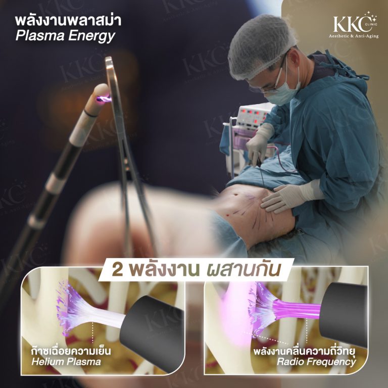 J-Plasma energy