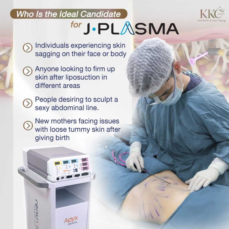 J-Plasma ideal candidates