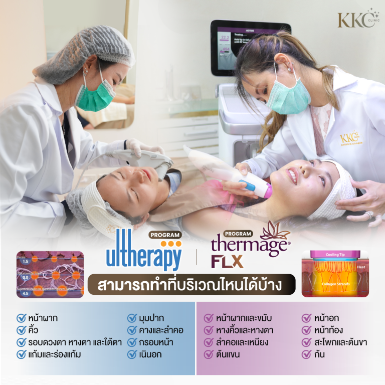 Treatable areas with Thermage and Ulthera