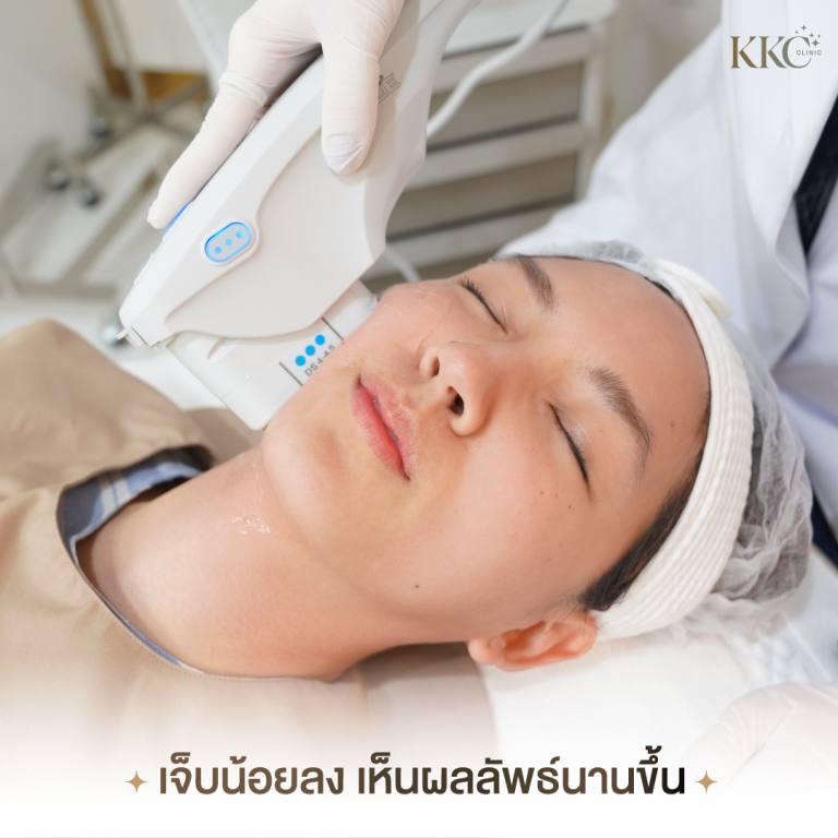 Client receiving Ulthera treatment at KKC Clinic