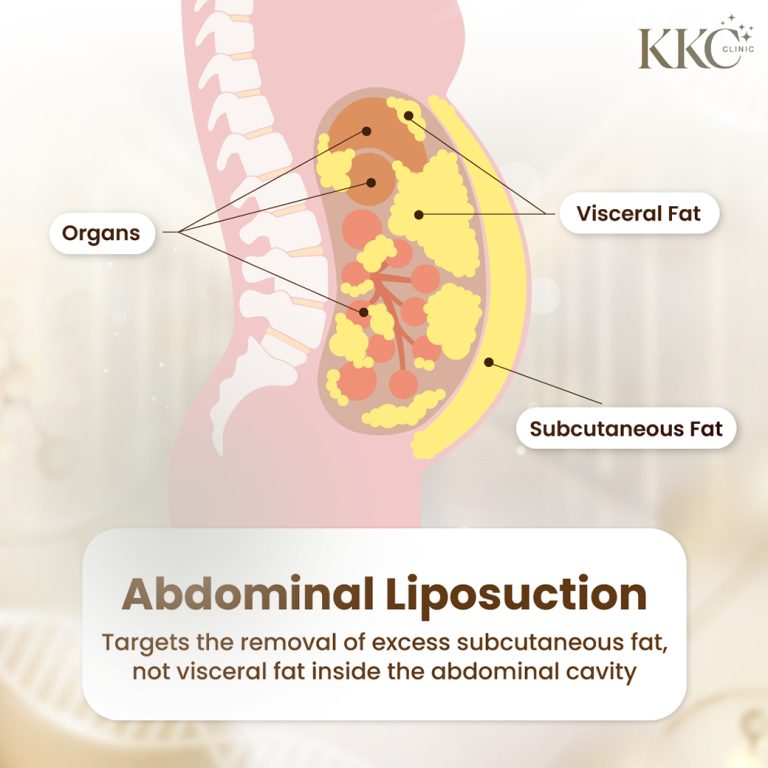 An anatomical illustration of a side view of the abdominal area shows the locations of organs, visceral fat, and subcutaneous fat.