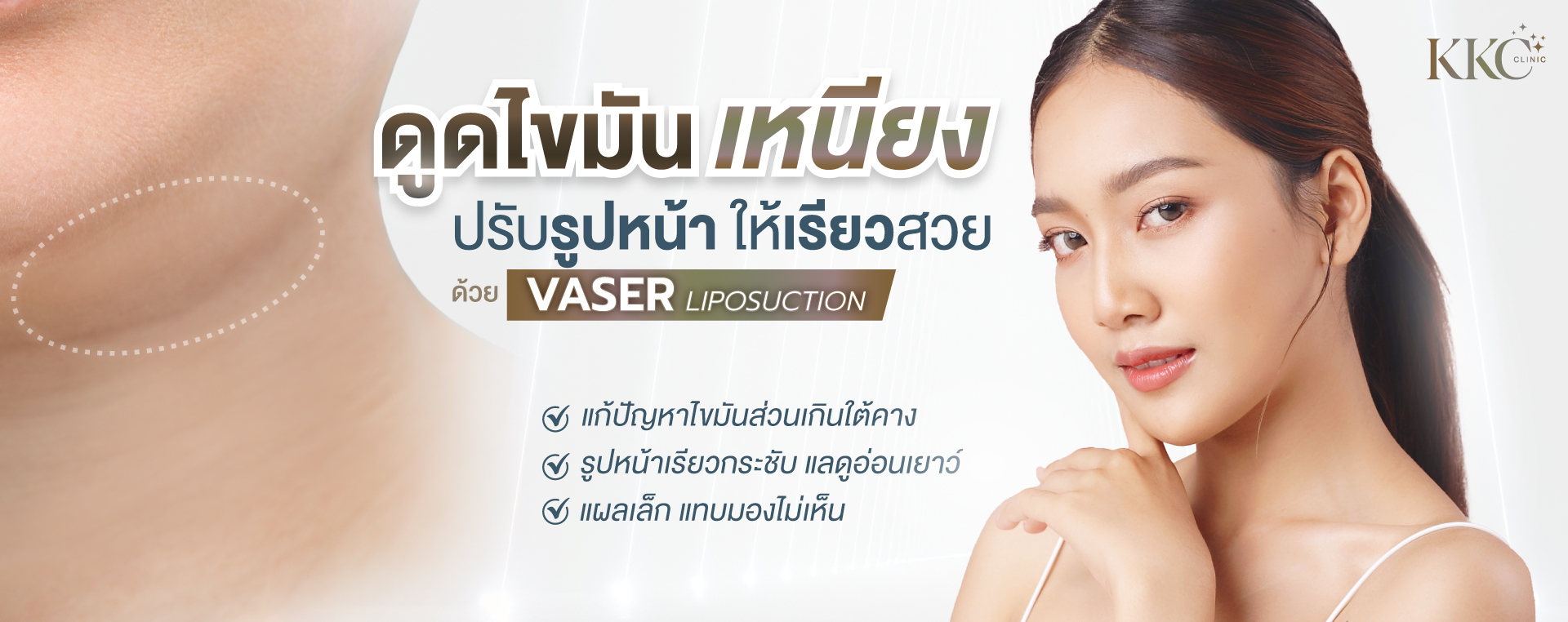 การดูดไขมันใต้คางด้วย VASER ที่ KKC Clinic โดยมีผู้หญิงที่มีกรามชัดเจน