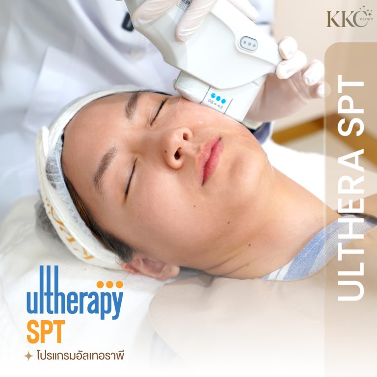 ผู้หญิงกำลังรับการรักษาด้วย Ultherapy SPT ที่ KKC Clinic
