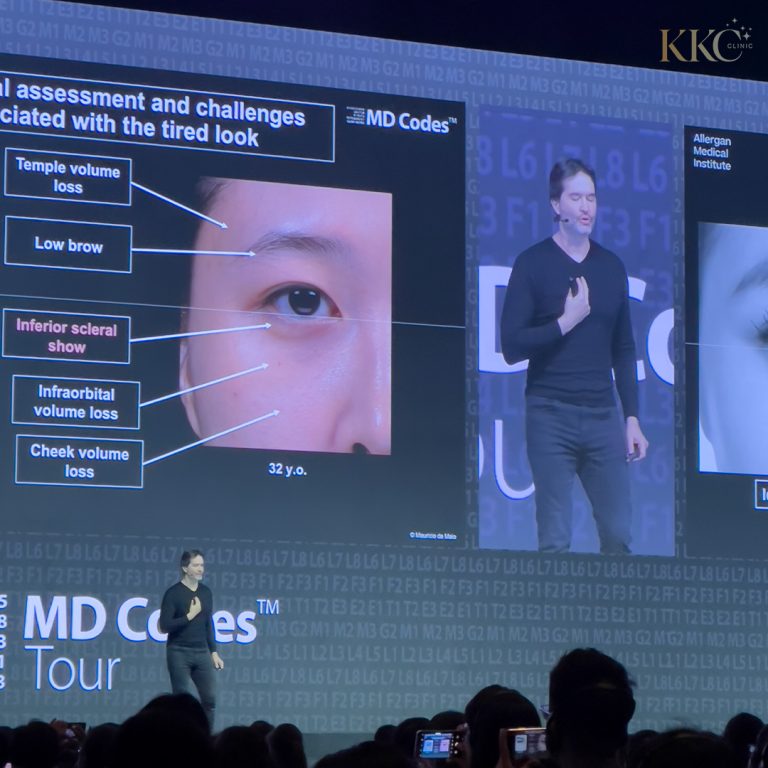 ดร.เมาริซิโอ เด ไมโอ (Dr. Mauricio de Maio) วิทยากรในงาน MD Codes ยืนอยู่หน้าสไลด์นำเสนอขนาดใหญ่ที่วิเคราะห์การประเมินใบหน้าและความท้าทายที่เกี่ยวข้องกับลักษณะใบหน้าที่ดูเหนื่อยล้า