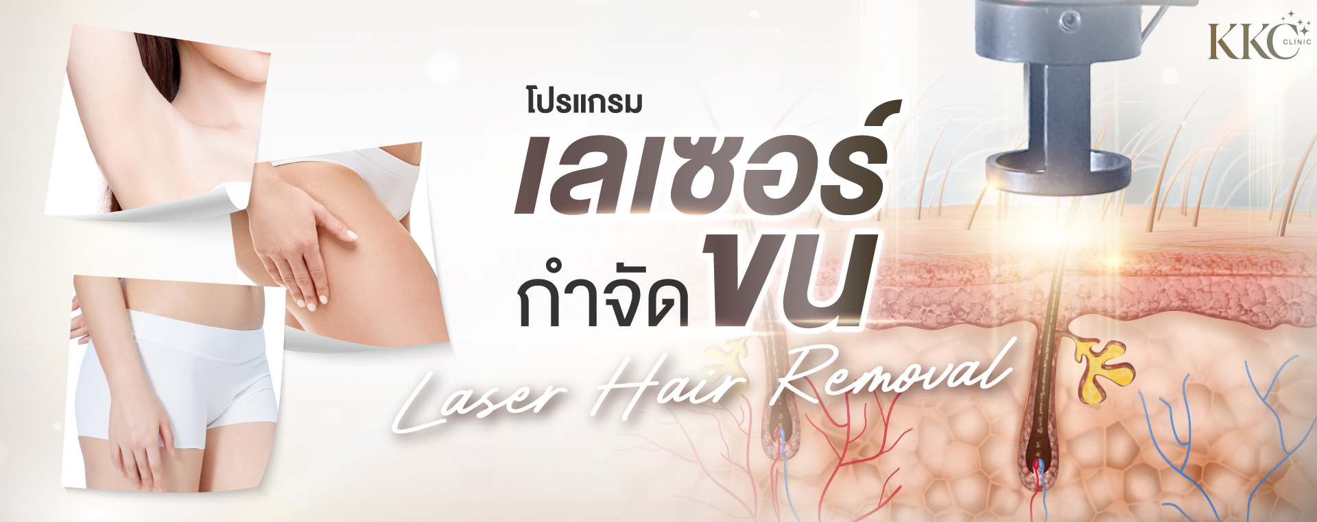 ภาพโคลสอัพของรักแร้ ต้นขา และเอวของผู้หญิง พร้อมภาพแสดงเลเซอร์ที่กำลังกำจัดขน