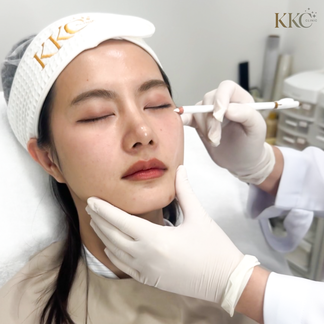 Asian MD Codes: Transform Your Face Like You've Had Surgery | KKC Clinic