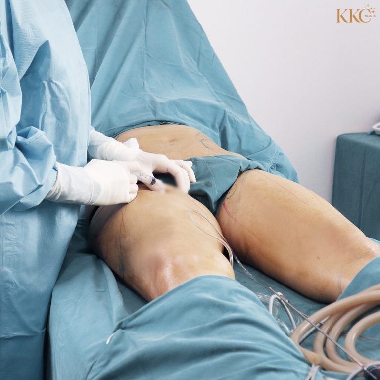 A doctor administering anesthesia injection into the patient's thigh, with the patient lying on a surgical table, covered in a sterile drape.