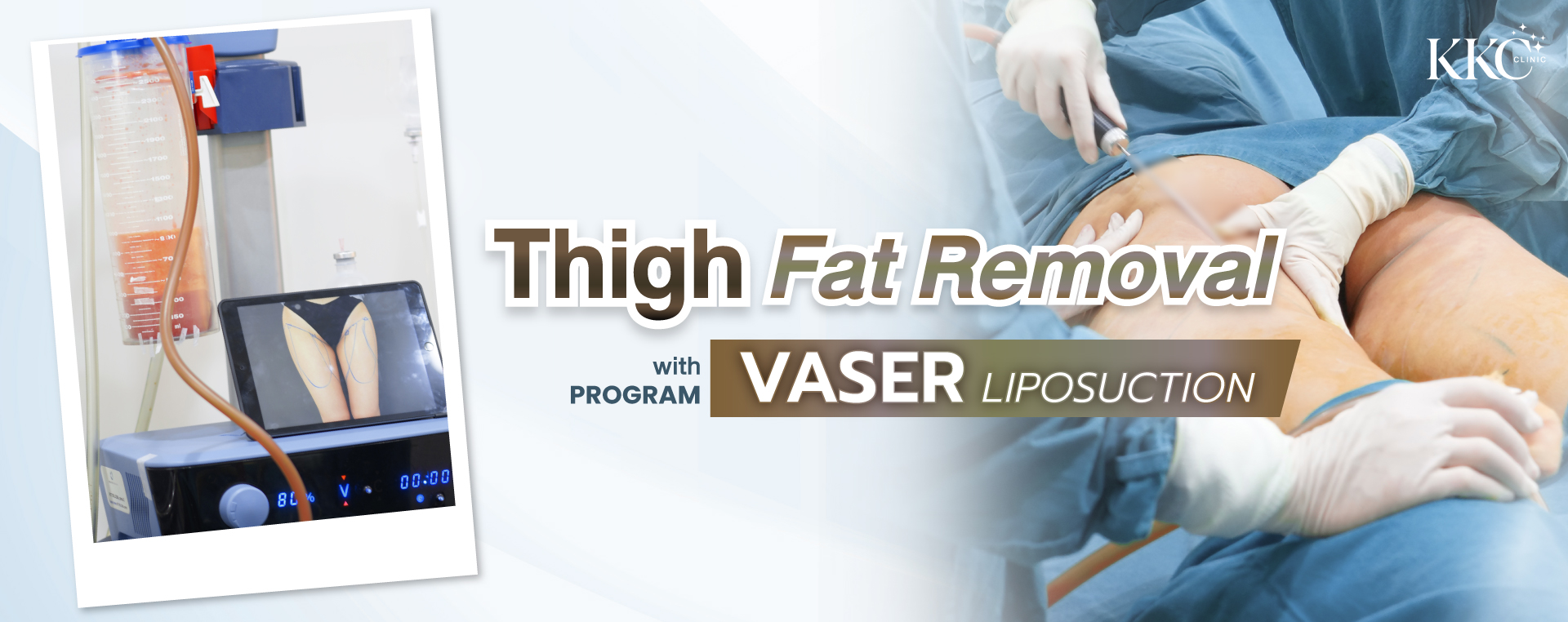 Liposuction machine with a canister containing removed fat and a tablet displaying an image of a patient's thighs. The right side shows a doctor performing the liposuction procedure on a patient's thighs.