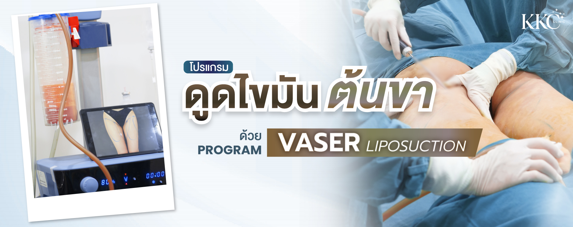 โฆษณาสำหรับโปรแกรมดูดไขมันต้นขาโดยใช้เทคโนโลยี VASER แสดงเครื่องมือทางการแพทย์ ไขมันที่ถูกดูดออก และต้นขาของผู้ป่วยที่กำลังรักษา