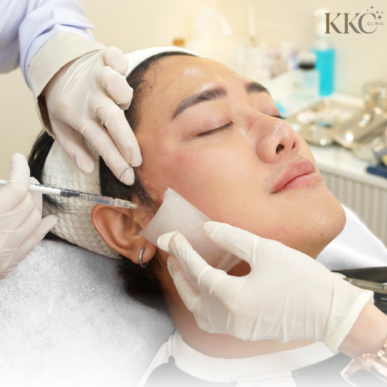 ผู้ป่วยชายกำลังรับการฉีดโบท็อกซ์ที่ KKC Clinic โดยแพทย์กำลังฉีดบริเวณขมับอย่างระมัดระวังและใช้แผ่นน้ำแข็งเพื่อลดการบวม