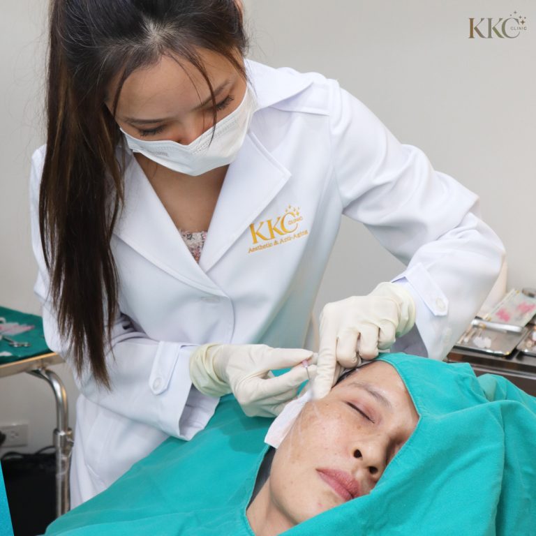 พญ.วรวรรณ เตชะสมบูรณ์ ที่ KKC Clinic กำลังดำเนินการรักษาร้อยไหมบนใบหน้าผู้ป่วย โดยกำลังใส่ไหมอย่างระมัดระวังขณะที่ผู้ป่วยนอนหลับตาและคลุมด้วยผ้าผ่าตัด