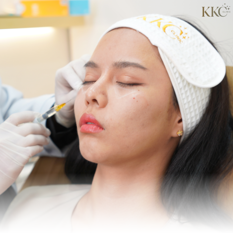 ผู้หญิงกำลังรับการฉีดฟิลเลอร์บนใบหน้า ขณะสวมที่คาดผมและหลับตาที่ KKC Clinic
