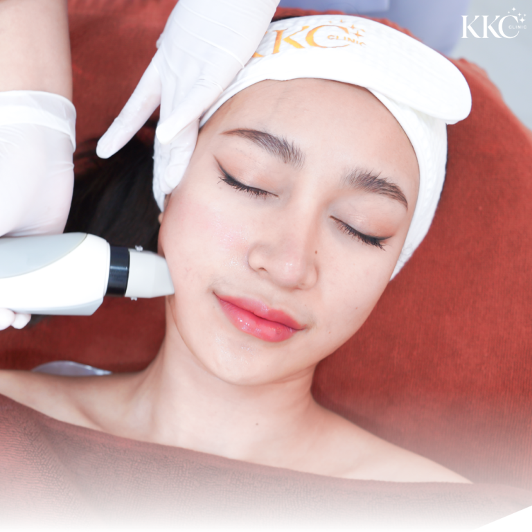 ผู้หญิงกำลังรับการทำ Intra 4D เพื่อฟื้นฟูผิวหน้าที่ KKC Clinic