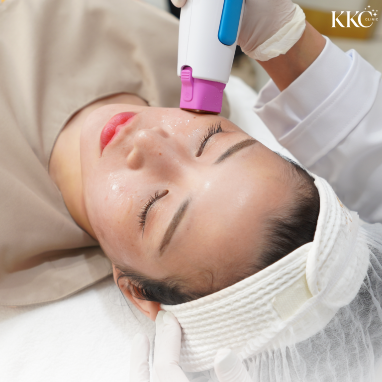 ผู้หญิงกำลังรับการทำ Thermage เพื่อยกกระชับผิวและฟื้นฟูใบหน้าที่ KKC Clinic