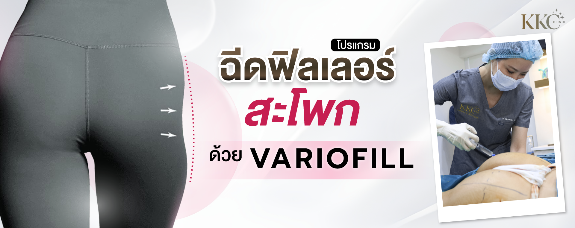 แบนเนอร์โปรโมชั่นสำหรับการฉีดฟิลเลอร์สะโพกด้วย Variofill ที่ KKC Clinic ด้านซ้ายแสดงภาพระยะใกล้ของบริเวณสะโพก พร้อมลูกศรที่ชี้ไปยังจุดที่ต้องการปรับปรุง