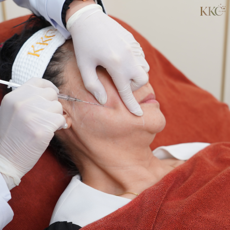 ผู้หญิงกำลังรับการฉีด Sculptra บริเวณแก้มที่ KKC Clinic โดยผู้เชี่ยวชาญที่สวมถุงมือ