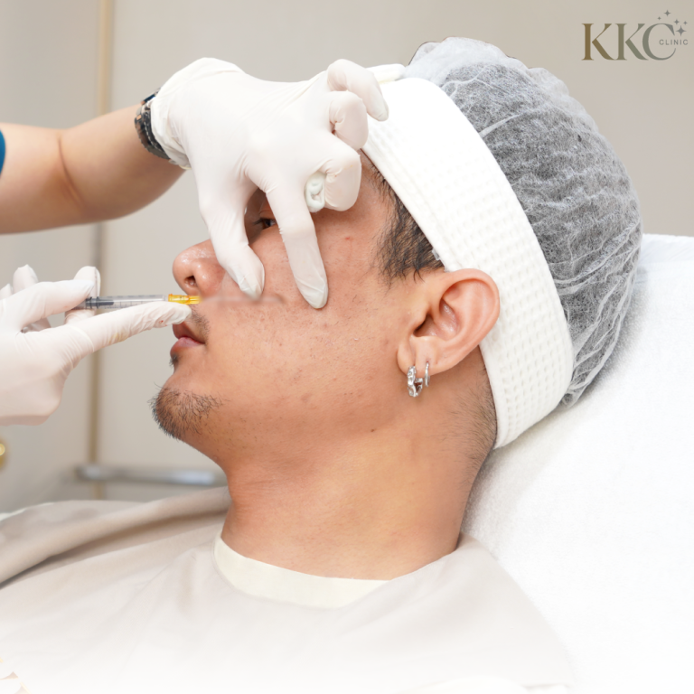 ผู้ป่วยชายกำลังรับการฉีด Sculptra ที่ KKC Clinic โดยแพทย์กำลังฉีดบริเวณร่องแก้มอย่างระมัดระวัง