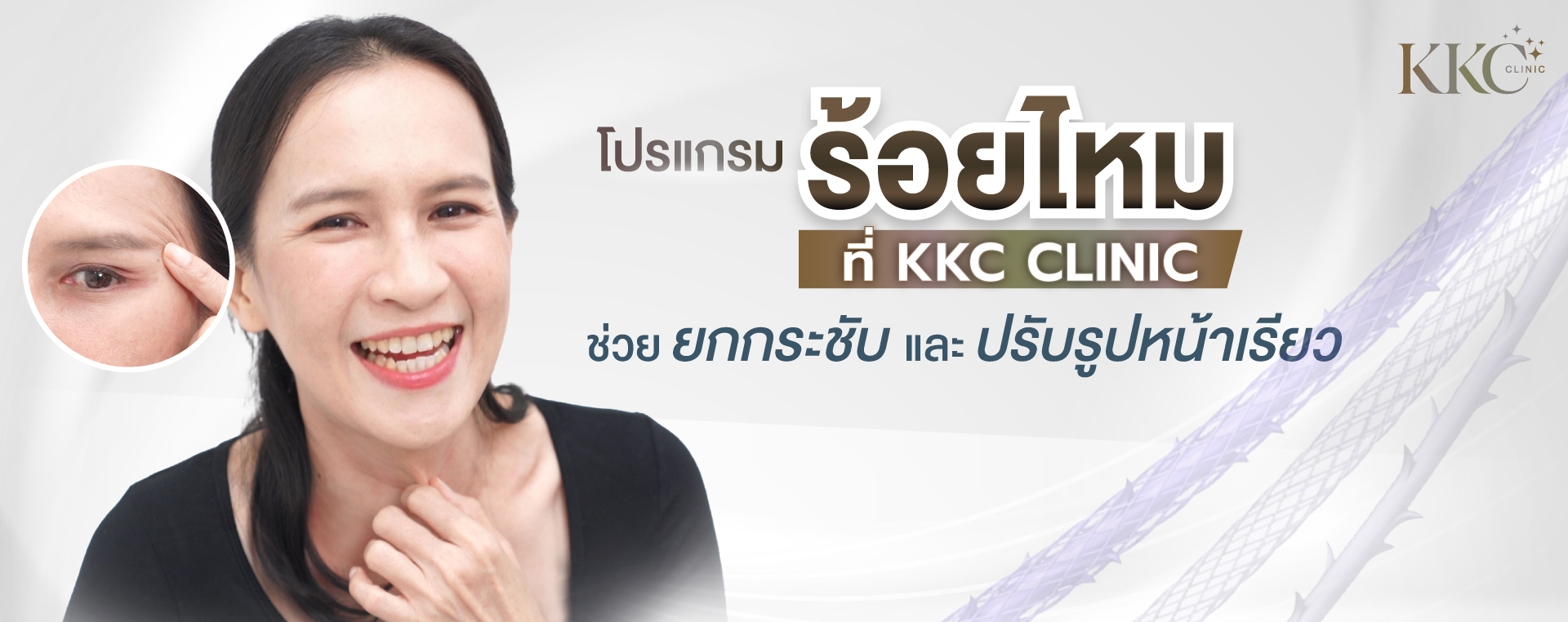 ผู้หญิงยิ้ม พร้อมเน้นริ้วรอยใต้ตา โฆษณาโปรแกรมร้อยไหมที่ KKC Clinic เพื่อช่วยยกกระชับและปรับรูปหน้า