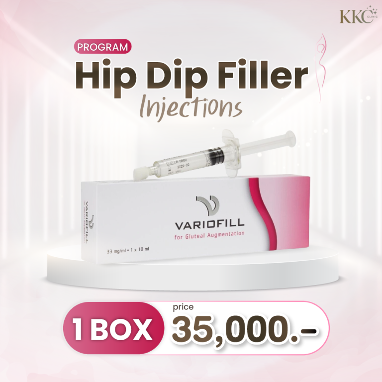 Promotional image for the Hip Dip Filler Injections program at KKC Clinic featuring a Variodfill box and syringe for gluteal augmentation. The price is displayed as '1 Box, 35,000 Baht.'