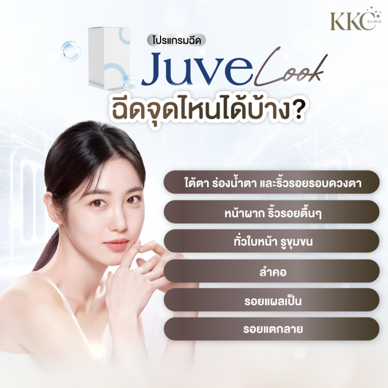 ภาพโปรโมทโปรแกรมฉีด JuveLook ที่ KKC Clinic มีหญิงสาวผิวกระจ่างใส ข้อความเน้นจุดที่สามารถฉีด JuveLook ได้ เช่น ใต้ตา ร่องน้ำตา ริ้วรอยรอบดวงตา ริ้วรอยตื้นๆ รูขุมขนกว้าง ลำคอ รอยแผลเป็น และรอยแตกลาย
