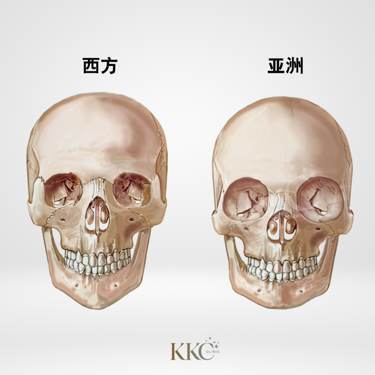 两个头骨的对比图，左侧标注为“西方”，右侧标注为“亚洲”，突显解剖学差异。
