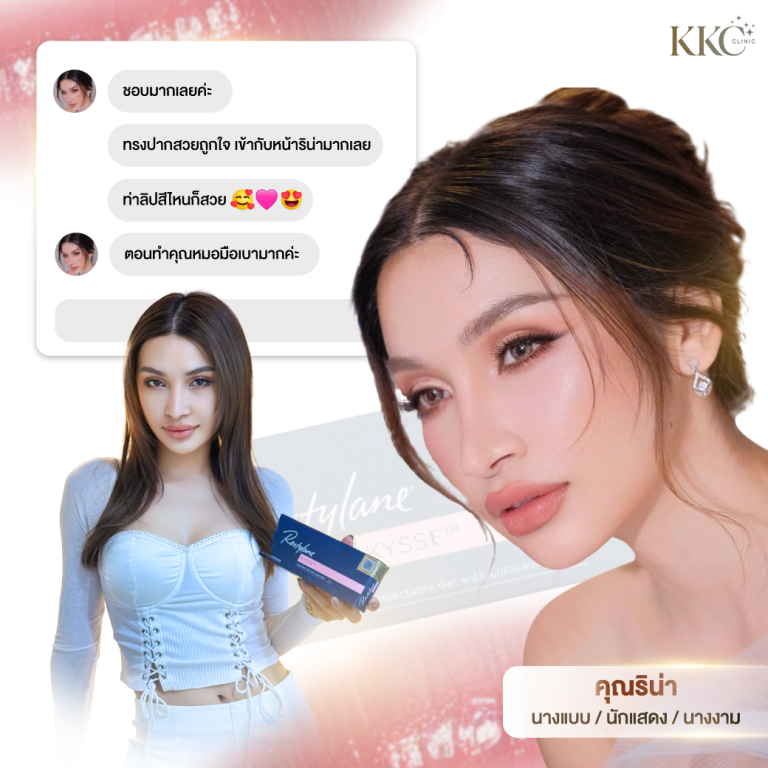 คอลลาจนางแบบโชว์ริมฝีปากที่ดูสวยเป็นธรรมชาติหลังการฉีดฟิลเลอร์ Restylane Kysse พร้อมข้อความรีวิวที่แสดงความพึงพอใจเกี่ยวกับรูปทรงริมฝีปากที่สวยงาม นางแบบถือกล่อง Restylane Kysse ในภาพหนึ่ง และใบหน้าสวยสดใสในอีกภาพหนึ่ง