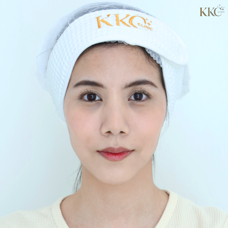 ภาพพอร์ตเทรตด้านหน้าของผู้หญิงใบหน้าเรียบสงบ สวมที่คาดผมแบรนด์ KKC Clinic บนพื้นหลังสีอ่อน