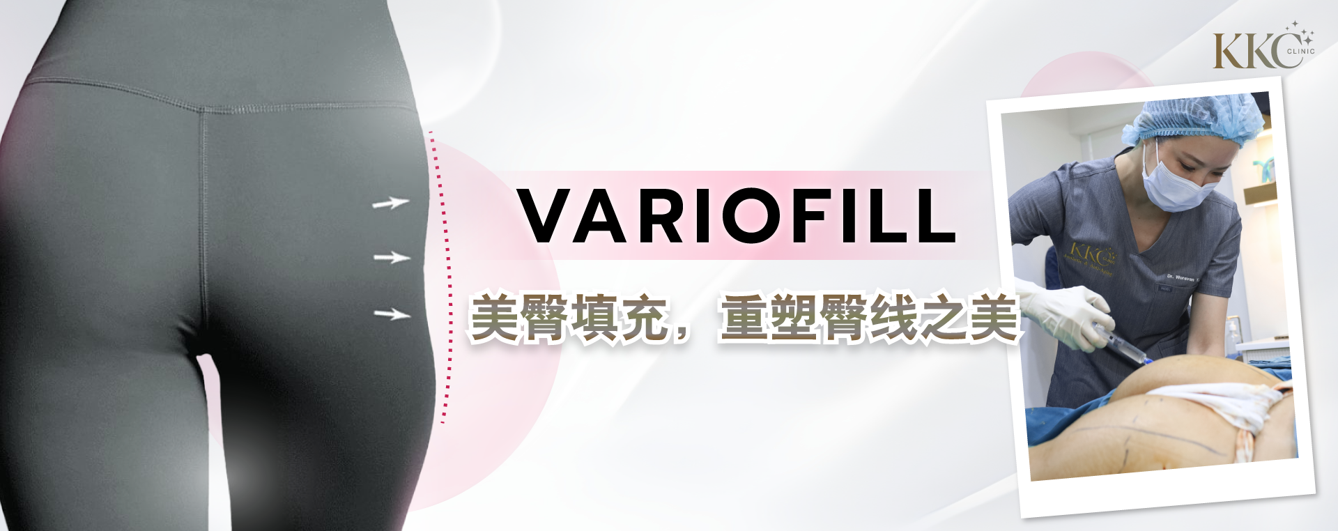 图像展示穿紧身裤的人的下半身，箭头指向臀侧区域，标有“Variofill”字样。右侧为KKC医疗美容诊所的医生正在为患者的臀部区域进行注射治疗。