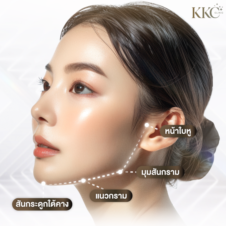 ด้านข้างของผู้หญิงที่มีผิวเรียบเนียน เปล่งประกาย พร้อมเส้นประและป้ายกำกับที่ระบุจุดโครงสร้างกรอบหน้า เช่น หน้าใบหู มุมสันกราม แนวกราม และสันกระดูกใต้คาง