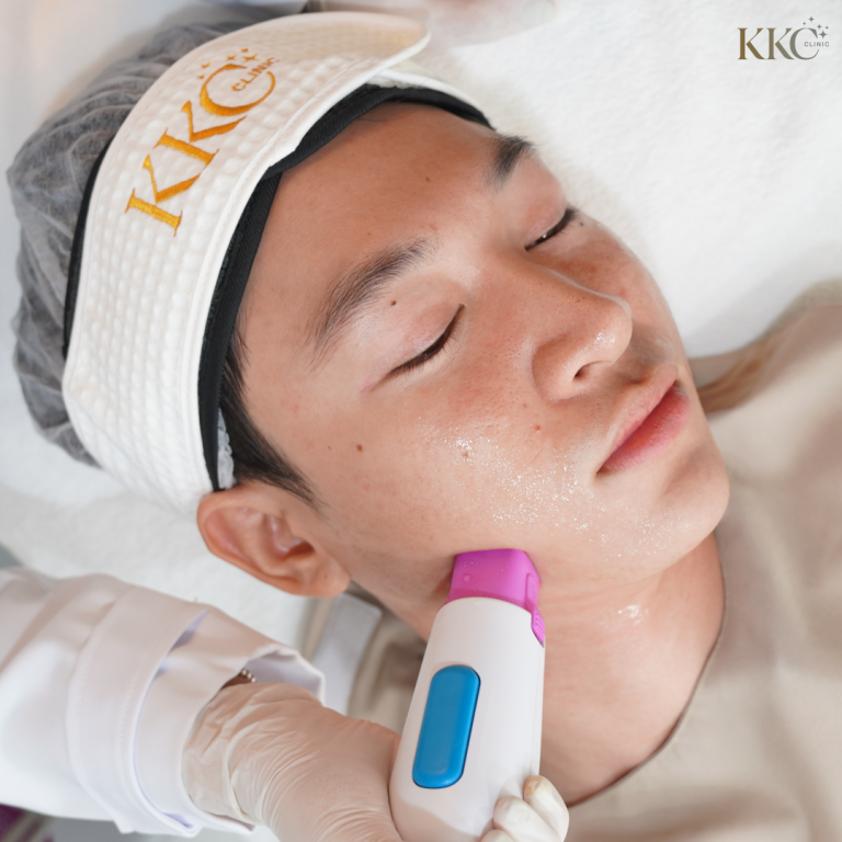 ผู้ชายกำลังรับการทำ Thermage บนใบหน้าเพื่อกระชับผิวและปรับรูปหน้า ที่ KKC Clinic