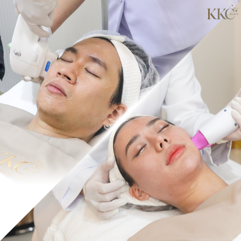 ภาพเปรียบเทียบแสดงผู้ชายกำลังรับการทำ Ultherapy และผู้หญิงกำลังทำ Thermage ที่ KKC Clinic