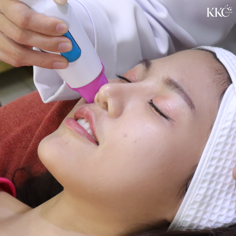 หญิงสาวกำลังรับการทำ Thermage ที่ KKC Clinic โดยมีอุปกรณ์มือถือสัมผัสที่บริเวณจมูกเพื่อยกกระชับและปรับรูปหน้า
