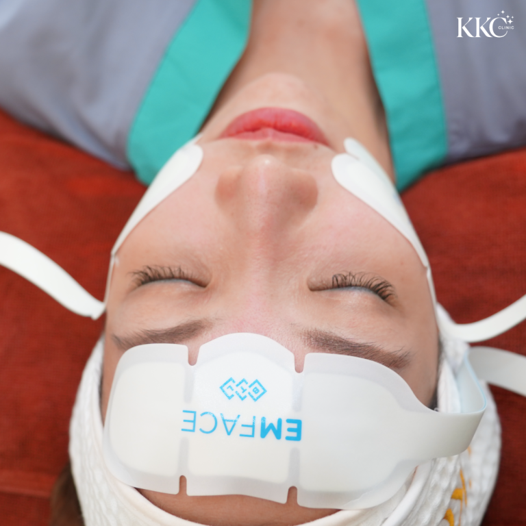 ภาพใกล้ของหญิงสาวนอนราบพร้อมแผ่น EMFACE ติดอยู่บนหน้าผากและแก้มระหว่างการรักษายกกระชับใบหน้าแบบไม่ผ่าตัด