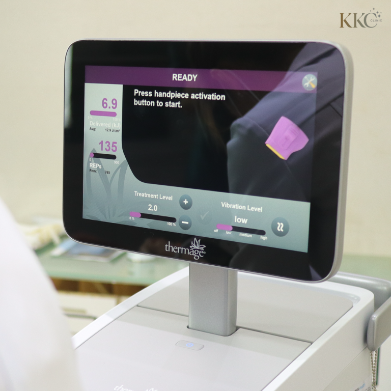ภาพหน้าจอเครื่อง Thermage แสดงการตั้งค่าระดับการรักษา ระดับการสั่น และสถานะพร้อมใช้งาน