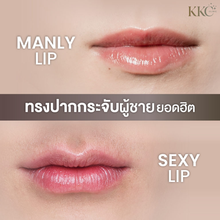 ภาพเปรียบเทียบทรงปากชายยอดนิยมระหว่าง "Manly Lip" และ "Sexy Lip" โดยแสดงภาพปากโคลสอัพที่มีรูปร่างและความเงาต่างกัน