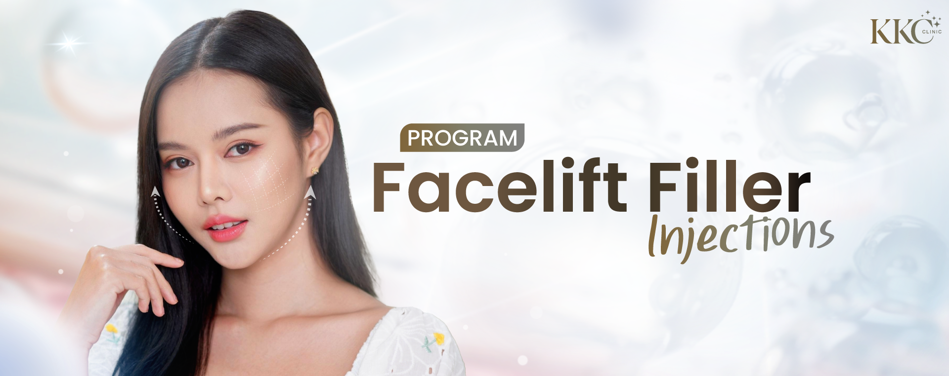 Woman with flawless skin showcasing facial filler lifting treatment with arrows indicating targeted areas on the cheeks.