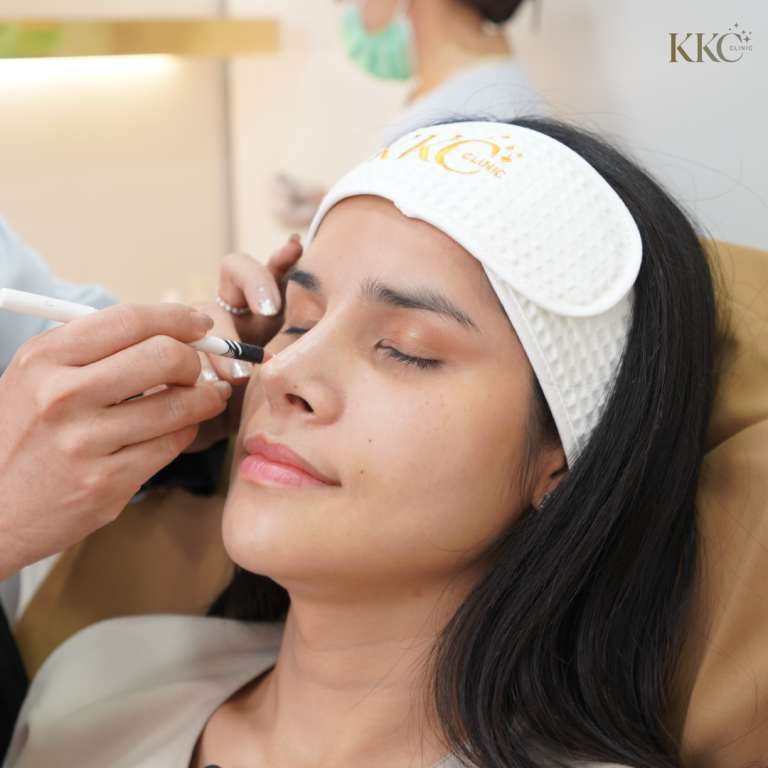 ผู้ป่วยที่ KKC Clinic สวมผ้าคาดศีรษะพร้อมโลโก้ โดยผู้เชี่ยวชาญกำลังใช้ดินสอสีขาวทำเครื่องหมายบริเวณใต้ตาเพื่อเตรียมการฉีดโบท็อกซ์