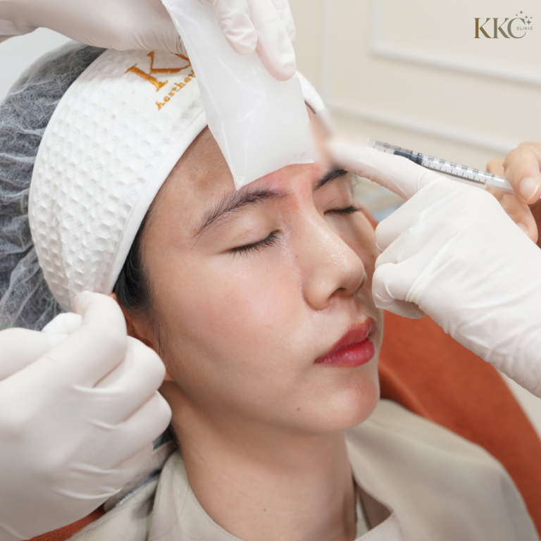 ผู้ป่วยที่ KKC Clinic กำลังรับการฉีดโบท็อกซ์บริเวณหน้าผาก โดยมีการประคบเย็นบนหน้าผากเพื่อลดความไม่สบายระหว่างการรักษา