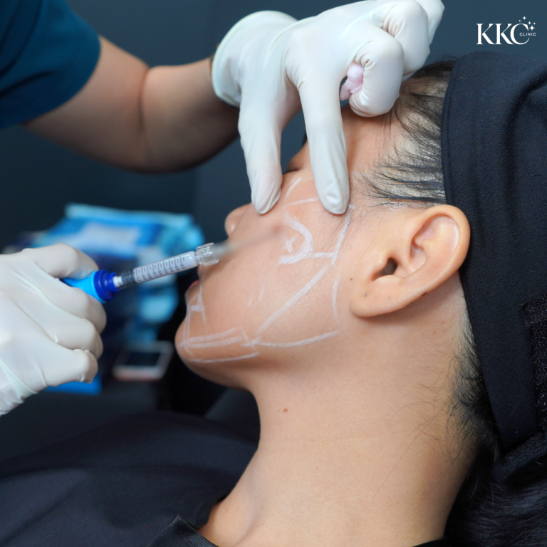 ผู้ป่วยกำลังรับการฉีดที่ KKC Clinic โดยมีการทำเครื่องหมายบนใบหน้าเพื่อระบุตำแหน่งที่ต้องการรักษาอย่างแม่นยำ