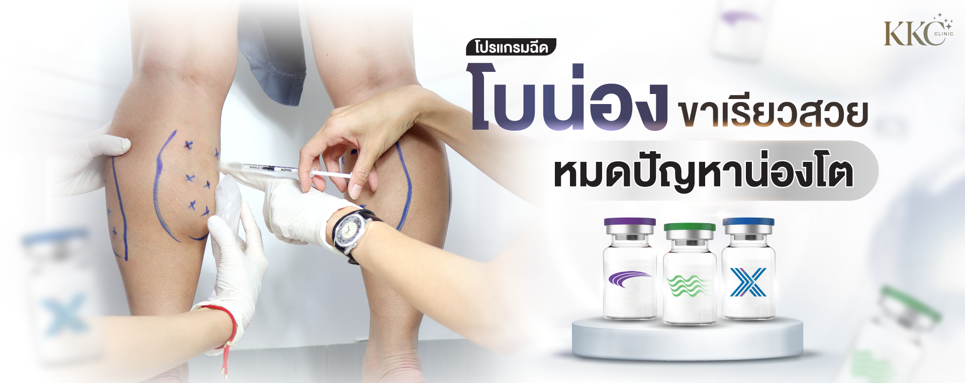 ผู้เชี่ยวชาญทางการแพทย์กำลังฉีดโบท็อกซ์บริเวณน่อง โดยมีการทำเครื่องหมายบนขาเพื่อช่วยในการฉีด ขวดโบท็อกซ์แสดงอยู่ทางด้านขวา