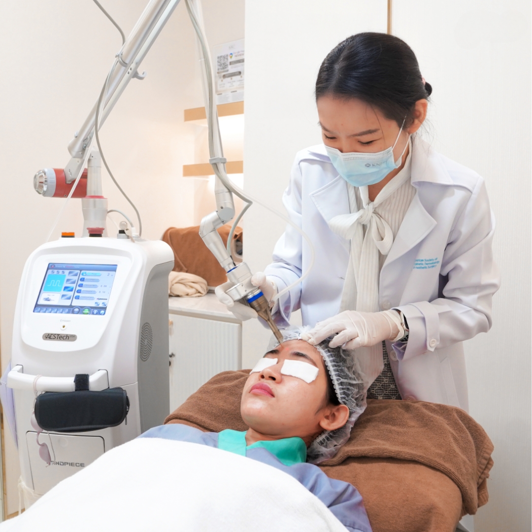 Doctor performing CO₂ laser treatment on a patient's forehead.