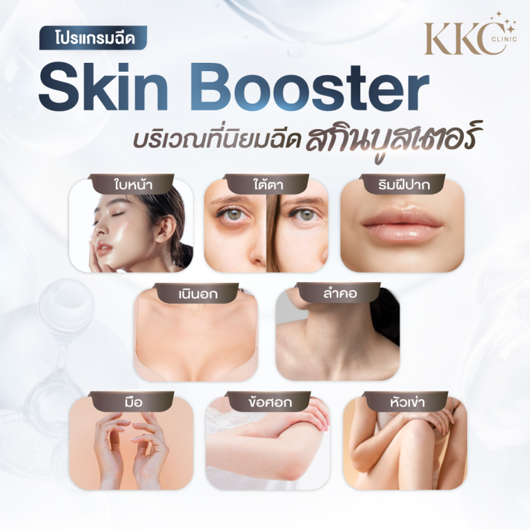 บริเวณยอดนิยมสำหรับฉีด Skin Booster ได้แก่ ใบหน้า ใต้ตา ริมฝีปาก เนินอก ลำคอ มือ ข้อศอก และหัวเข่า