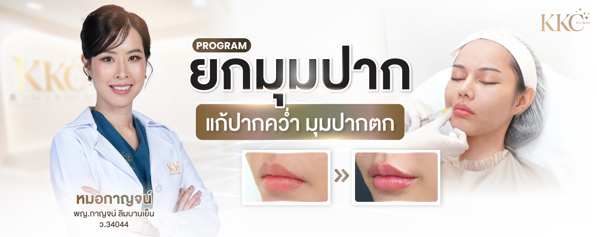 พญ.กาญจน์ ลิมบานเย็น ในชุดกาวน์สีขาวกอดอก โปรโมทโปรแกรมยกมุมปาก ผู้ป่วยได้รับการฉีด พร้อมภาพเปรียบเทียบก่อนและหลังปรับรูปปาก