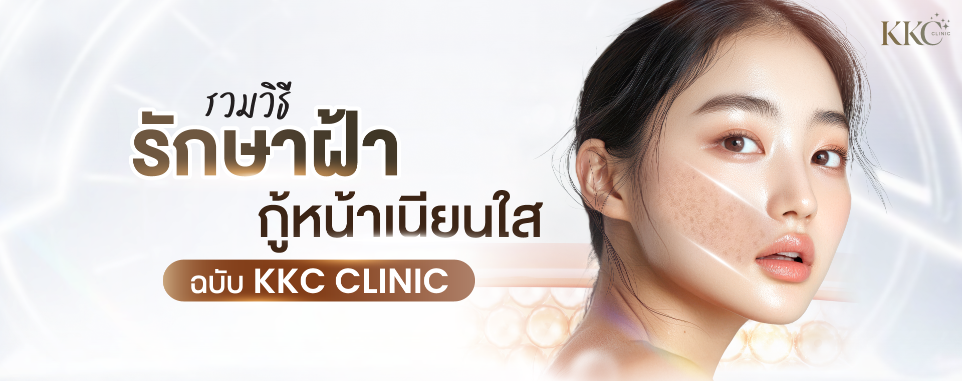 แบนเนอร์โปรโมตรักษาฝ้า ภาพโคลสอัพของใบหน้าผู้หญิงโดยด้านหนึ่งมีฝ้าและอีกด้านผิวเรียบเนียนกระจ่างใส ข้อความเน้นการรักษาฝ้าอย่างมีประสิทธิภาพที่ KKC Clinic