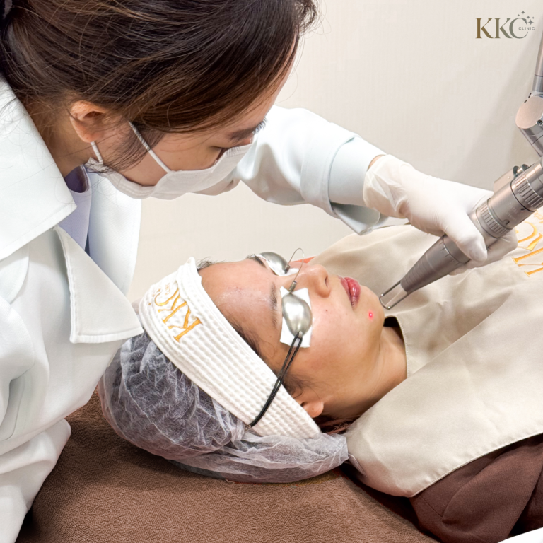 ผู้เชี่ยวชาญกำลังทำการรักษาด้วย Q-Switch Laser บริเวณคางของผู้ป่วยที่ KKC Clinic ผู้ป่วยนอนราบ สวมแว่นตาป้องกันและที่คาดผมที่มีโลโก้ของคลินิก