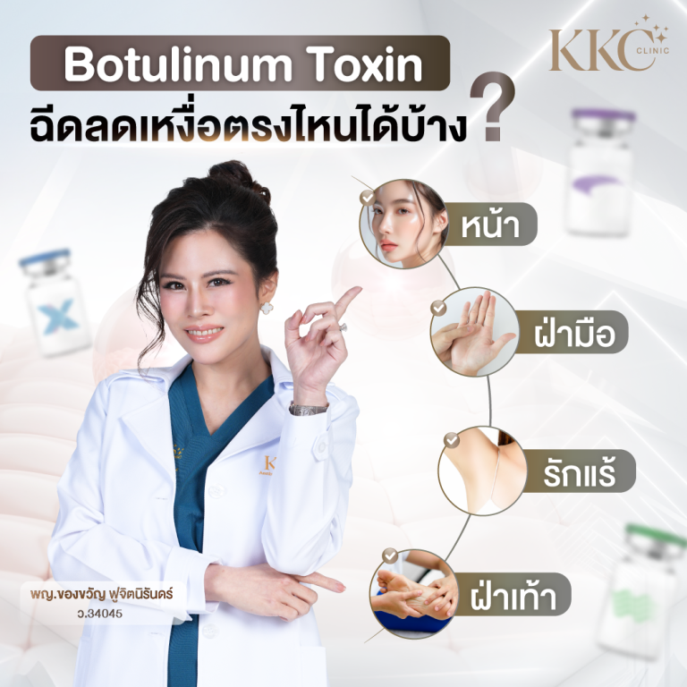 พญ.ของขวัญ ฟูจิตนิรันดร์ ชี้จุดที่สามารถฉีดโบทูลินัมท็อกซินเพื่อลดเหงื่อ ได้แก่ ใบหน้า ฝ่ามือ รักแร้ และฝ่าเท้า