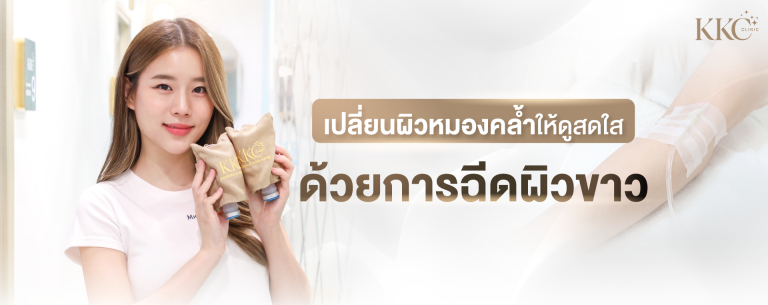 ผู้หญิงถือถุงคลุมสายน้ำเกลือสองอันพร้อมรอยยิ้มที่คลินิก KKC โปรโมตโปรแกรมฉีดผิวขาว โดยมีภาพแขนที่เสียบสายน้ำเกลือด้านขวาของภาพ