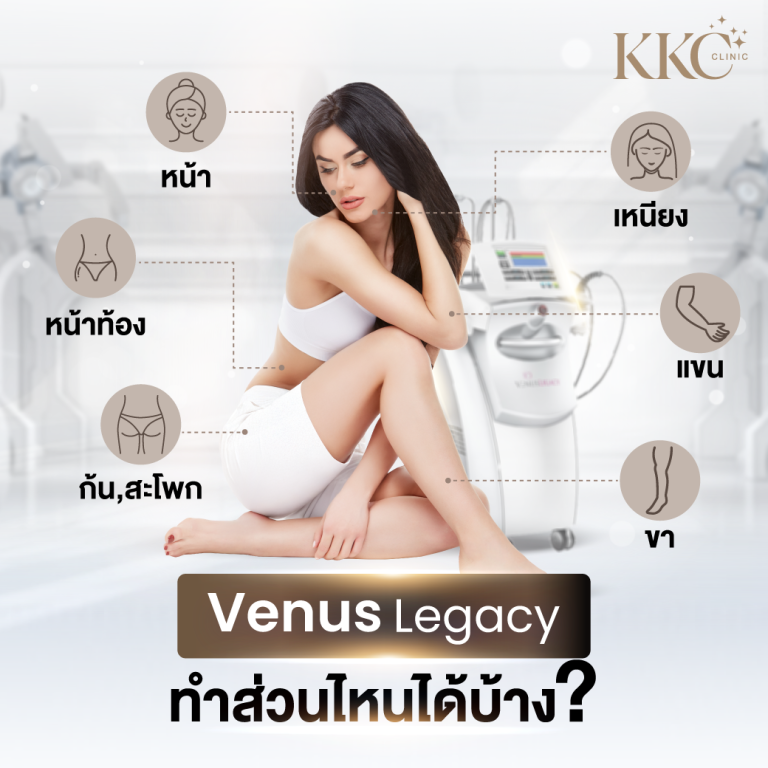 ผู้หญิงสวมชุดออกกำลังกายสีขาวนั่งข้างเครื่อง Venus Legacy มีเส้นประชี้ไปยังจุดที่สามารถทำการรักษาได้ พร้อมป้ายกำกับในภาษาไทย: ใบหน้า คอ แขน ขา หน้าท้อง และก้น/สะโพก