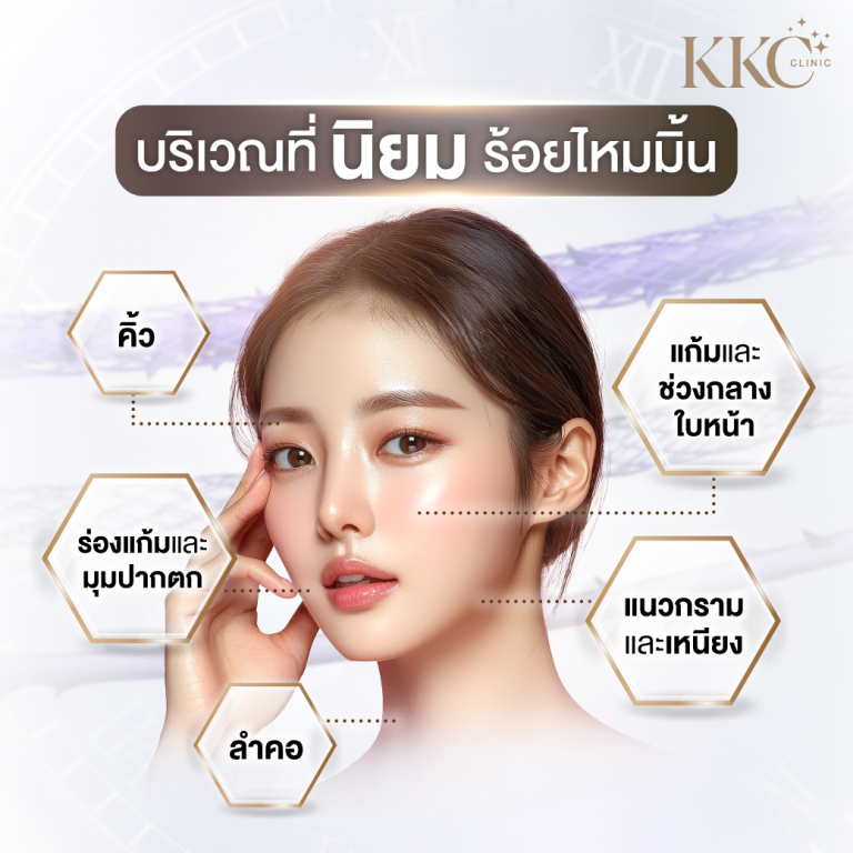 บริเวณที่นิยมร้อยไหมมินต์ เช่น คิ้ว แก้ม ร่องแก้ม มุมปากตก แนวกราม เหนียง และลำคอ