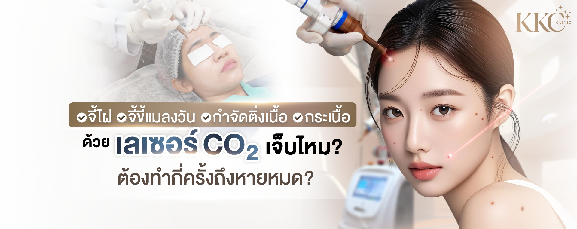 ผู้หญิงกำลังรักษาด้วยเลเซอร์ CO2 เพื่อกำจัดไฝ ขี้แมลงวัน และเนื้องอก พร้อมข้อความ “จี้ไฝ จี้ขี้แมลงวัน กำจัดติ่งเนื้อ กระเนื้อ ด้วยเลเซอร์ CO2 เจ็บไหม? ต้องทำกี่ครั้งถึงหายหมด?”